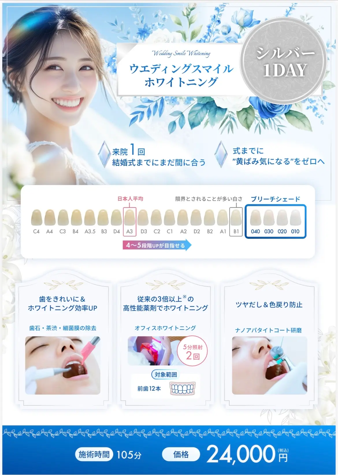 ウェディングスマイルホワイトニング