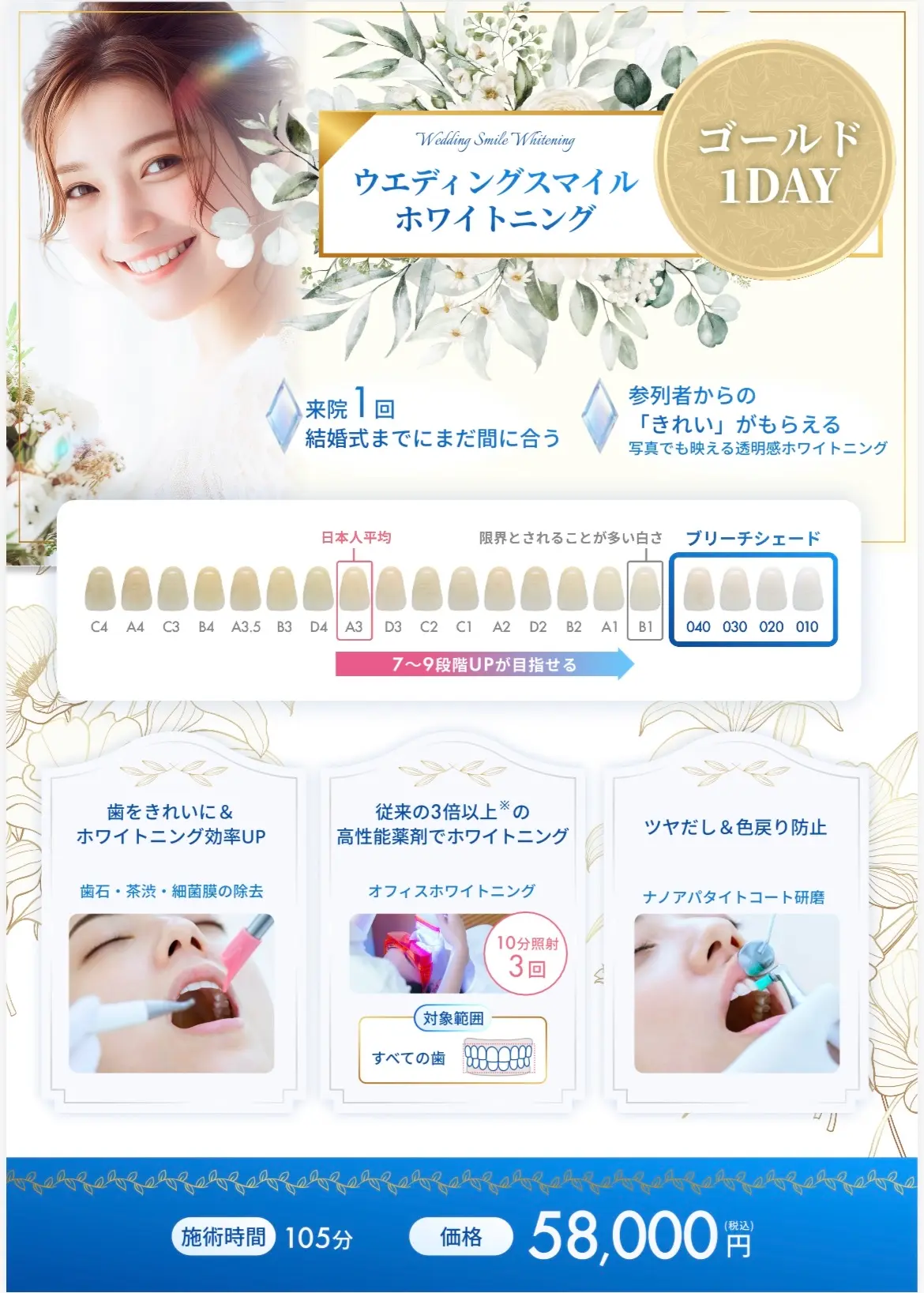 ウェディングスマイルホワイトニング