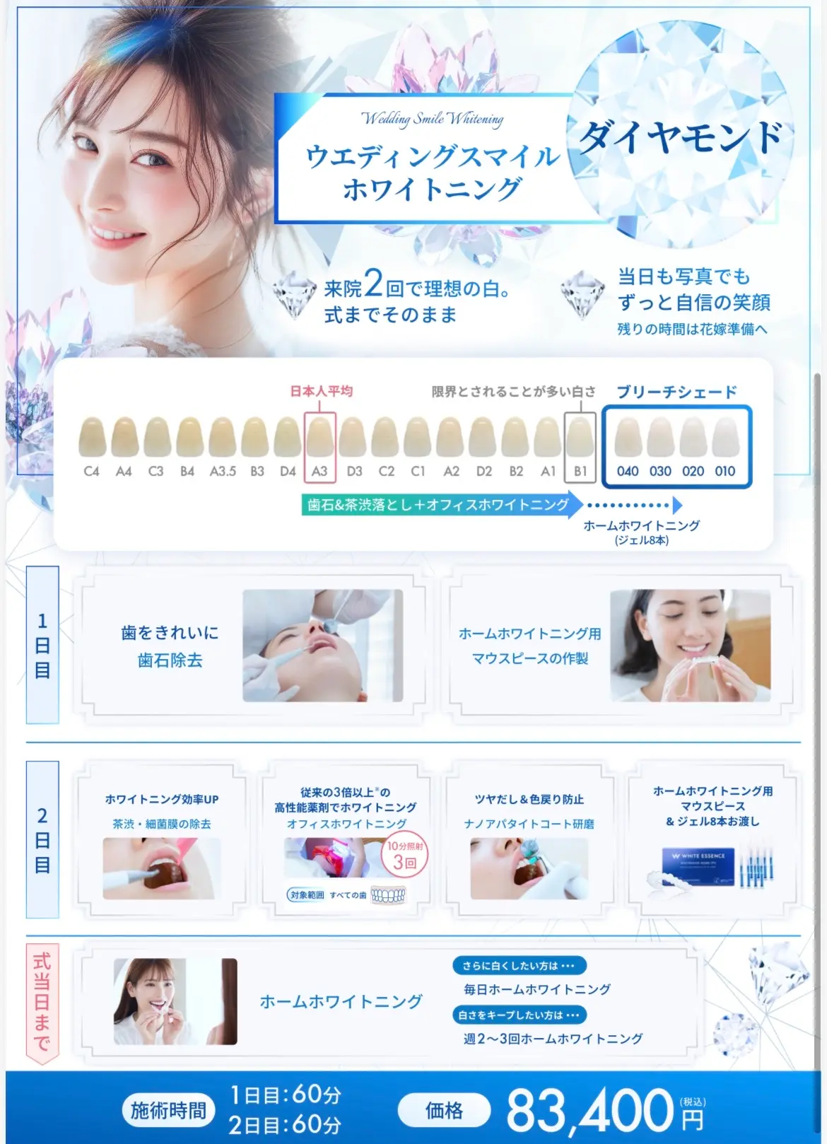 ウェディングスマイルホワイトニング