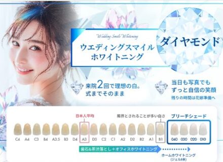 ウエディングスマイルホワイトニング　リリース！！