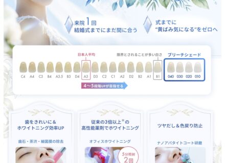 ウエディングスマイルホワイトニング シルバープラン