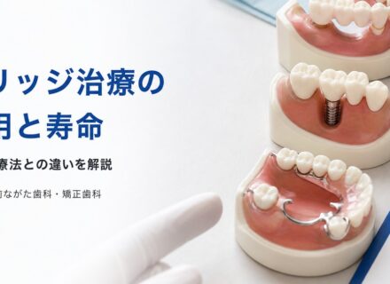 ブリッジとは?費用・寿命・他治療との違いを解説